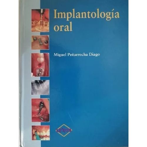 IMPLANTOLOGIA ORAL - MIGUEL PEÑARROCHA DIAGO