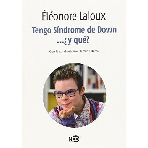 TENGO SINDROME DE DOWN, Y QUE?