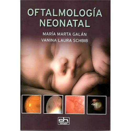 OFTALMOLOGIA NEONATAL - GALAN - SCHBIB