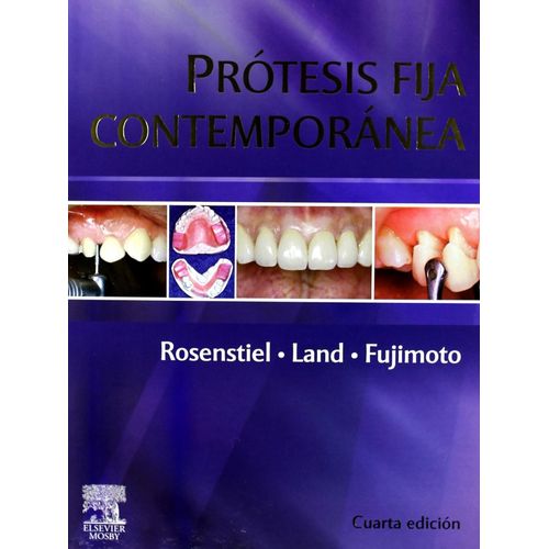 PROTESIS FIJA CONTEMPORANEA (4TA. EDICION) - S.F. ROSENSTIEL